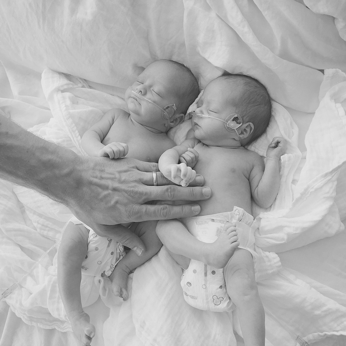 Photo of baby twins on oxygen